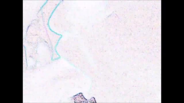 Throat style 2