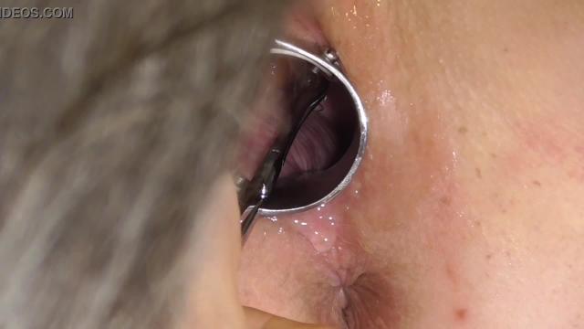 Breeding analslut - removing her birth control - analslut's cunt opened wide by speculum.  Her iud, coil - leaving her